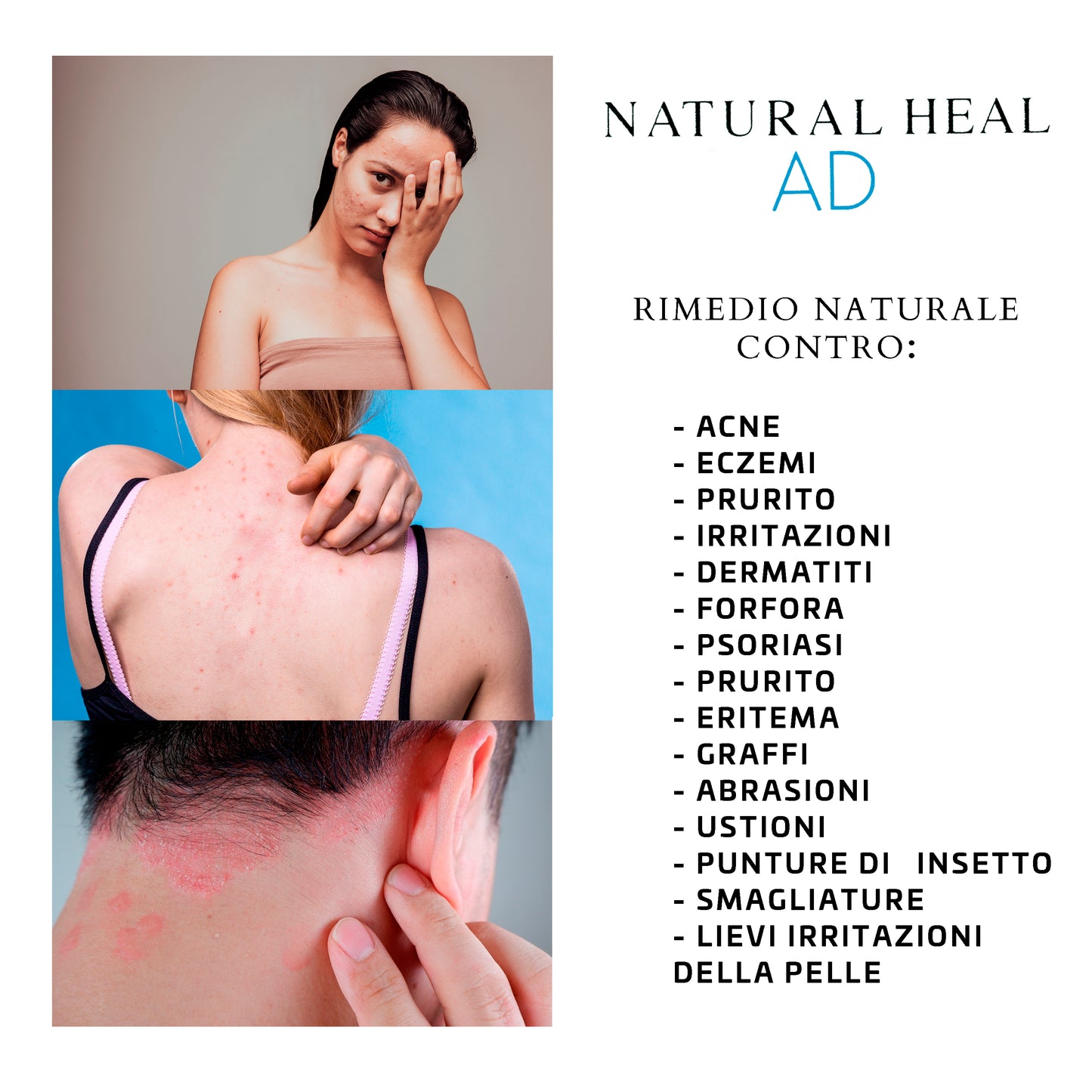 Natural Heal AD Crema Brufoli Viso – Trattamento Naturale per Imperfezioni Cutanee | La Canapa Sativa